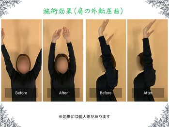 ボディ リセット アンド デザイン(Body Reset & Design)/【施術例】ビフォーアフター