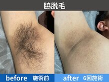 アテ 古波蔵店(ATE)の雰囲気（同じ悩みを持つスタッフが対応するので気軽にして通える♪）