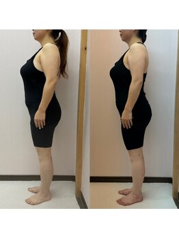 マーナ 谷山笹貫店(Ma-Na)/外食の多い40代の方ダイエット