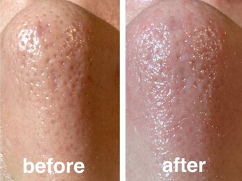 ヴィセラ(Vicella)/汚れスッキリ!柔肌!