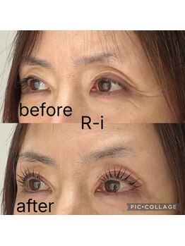 アールアイ(R-i)/アイリッドアップパーマ