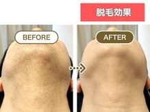 HGB 東山公園駅前店/男性｜20代｜学生