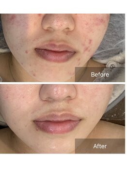 スリリアン 銀座/★お客さまビフォーアフター★