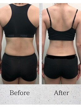 プライベートジム ゲート(Private Gym Gate)/ビフォーアフター