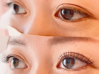 ジョリー(joli)/アジャストリフトテクニック