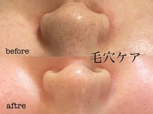 オル(Olu .)