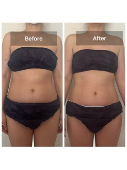 アールズ(R's)/ビフォーアフター