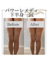 ミミィ(mimii.)/パワーレメディ下半身