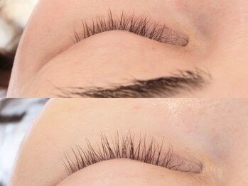 アイラッシュサロン ウインクル(Eyelash Salon Winkle)の写真/まつげが細い、短い、少ない。そんなあなたにお勧め☆ラッシュアディクトサロンケアで理想のまつげへ