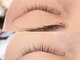 アイラッシュサロン ウインクル(Eyelash Salon Winkle)の写真/まつげが細い、短い、少ない。そんなあなたにお勧め☆ラッシュアディクトサロンケアで理想のまつげへ
