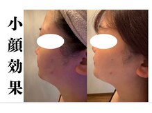 ルナ(Luna)/レモンボトル　小顔