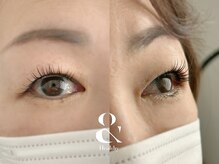 ムニ(muni)/&healthy【アンドヘルシー】