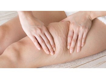 ワイグレイス(Y.GRACE)の写真/【速攻結果！スピード痩身★国際特許4D】このラジオ波、レベルが違う!中四国1台のマシンのパワーに感動★ 