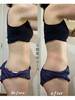 メゾンドケー(Maison de K)/お腹集中 10分 Before→After