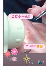 グラジュス(grazus)/毛穴