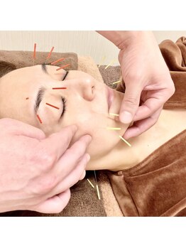 友愛はりきゅう美容整体院/リフトアップ美肌の美容鍼