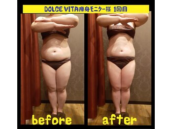 ドルチェヴィータ(DOLCE VITA)/痩身ダイエット1回でこの効果！