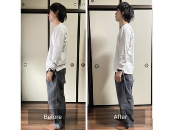 ミントのかべの整体院/姿勢矯正ビフォーアフター
