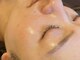 プロテュウス(PUROTUCE)の写真/【素肌に自信を♪】年齢を重ねるごとに悩みがつきない肌トラブルへアプローチ！理想のお肌へのお手伝い♪