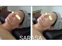 サラサ(SARASA)/お肌が揺らぎやすい方こそ
