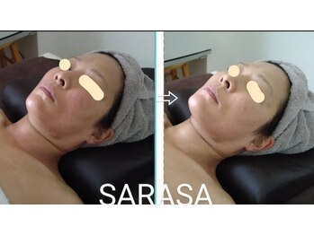 サラサ(SARASA)/お肌が揺らぎやすい方こそ