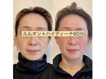 ヨサパーク シナモン 広尾店(YOSA PARK Cinnamon)の雰囲気（ルルオンと水素吸引！ダイエット×美容◎）
