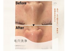 ミル(milu)の雰囲気（超音波スクライバーで毛穴奥の汚れも優しく除去）