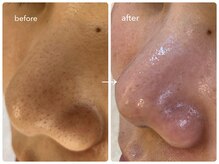 ナポデイズ(NAPODAYS)