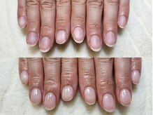 グラシナ なんば店/深爪/自爪育成/フィルイン