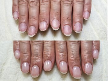 グラシナ なんば店/深爪/自爪育成/フィルイン