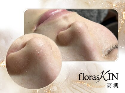 菌活フェイシャル専門店 florasKIN 高槻店【4月中旬 NEW OPEN（予定）】の写真