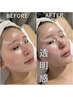 【平日限定10:00-16:00迄】毛穴・小顔・透明感*選べるfacial＋ヘッドスパ