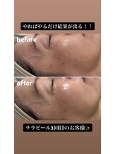 ラウラウ(laulau)/ララピールリピートのお客様