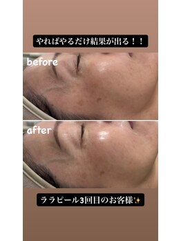 ラウラウ(laulau)/ララピールリピートのお客様