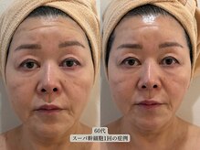 リボーン 柏(REBORN)の雰囲気（今ならまだ間に合う。「自惚れ肌」か「老け見え肌」かGWで決まる）