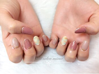 ミューオ(MIEUO)/ハンド定額コース6480