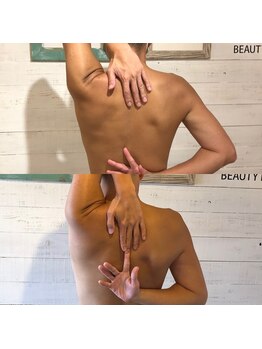 あるある整骨院アンドビューティー/肩こりツライ方は肩甲骨調整