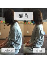 ミーツ(MEETS)/姿勢が悪い/猫背/頭痛　1回