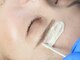 ハレノヒ(HaLeNoHi)の写真/フェイシャル脱毛で、お肌のトーンアップ＆お化粧ノリUP！産毛と一緒に毛穴もケアし、お顔をパット明るく★