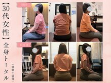 サクラ(SAKURA)/【30代】BeforeAfter