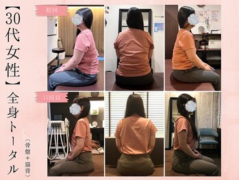 サクラ(SAKURA)/【30代】BeforeAfter