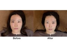 こじま 富雄団地接骨院/Before&After