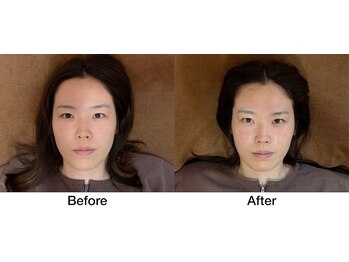 こじま 富雄団地接骨院/Before&After