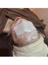 リッチフェイス 京都店(Rich Face)/美白効果◎炭酸パック