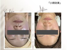 肌管理施術による変化事例
