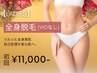 【1月限定特価★レディース脱毛】全身脱毛(VIO無し) 初回13,500円→11,000円