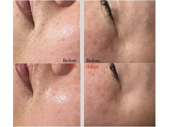 マシェリ(ma-che'rie)/バクチ甦生プログラム