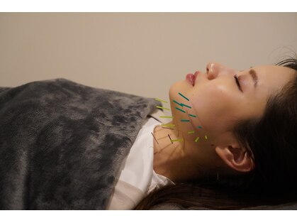 コガオ レンネ(Lenne)の写真