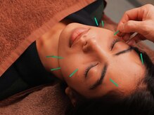 ラビサント 伏見稲荷(Ravissante)の雰囲気（美容鍼灸。お灸でお身体を調節）