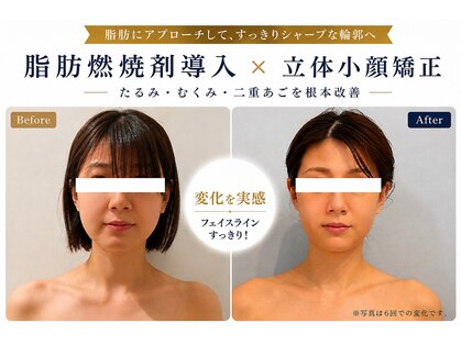 アセンド(ASCEND)の写真